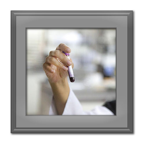 آزمایش غربالگری چیست و چگونه انجام می‌شود؟