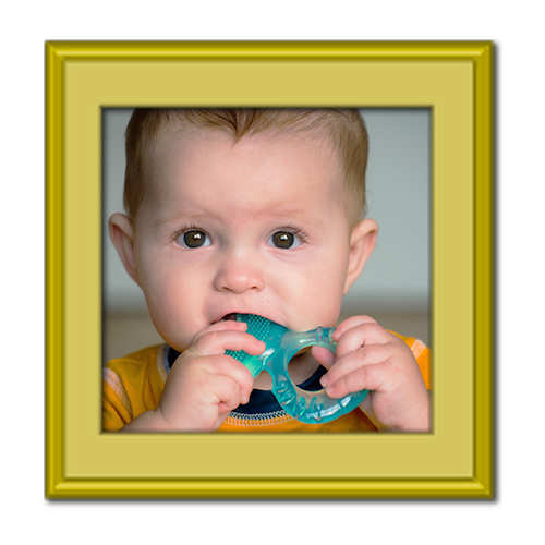 آفت دهان کودکان؛ علت، درمان