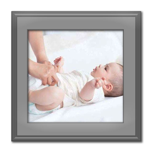 درمان سوختگی پای کودکان در اثر اسهال