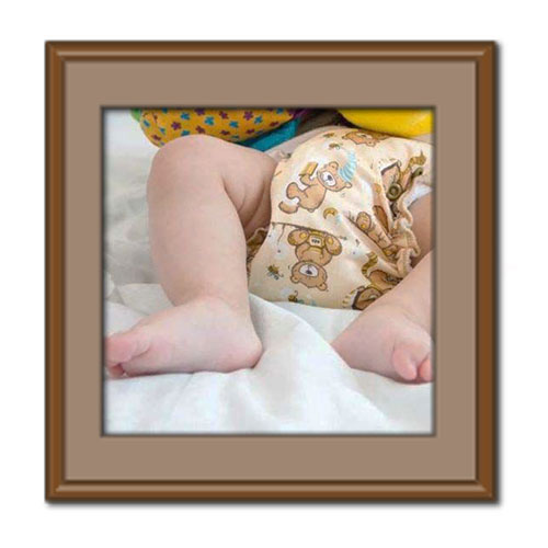 راهکارهای درمان خانگی ادرار سوختگی کودک