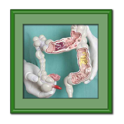 درمان گیاهی عفونت روده به کمک روش‌های موثر